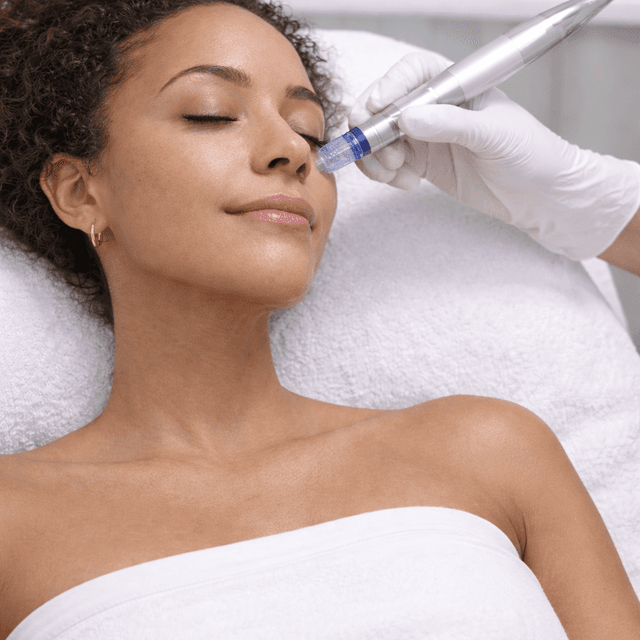 Microneedling with PDNR at Radiant Medbar in Frisco, TX